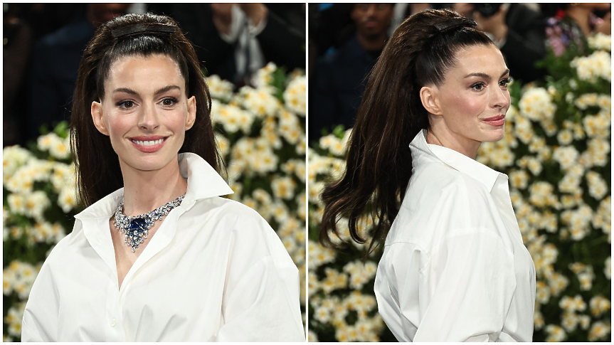 Тя не остарява! Какво се случва с Ан Хатауей и защо всички говорят за лицето ѝ?