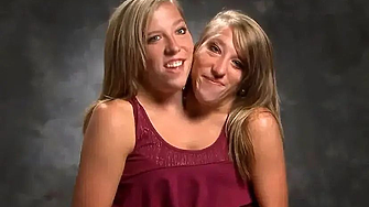 Историята на сиамските близначки Аби и Британи Хензел, които родиха и имат дете