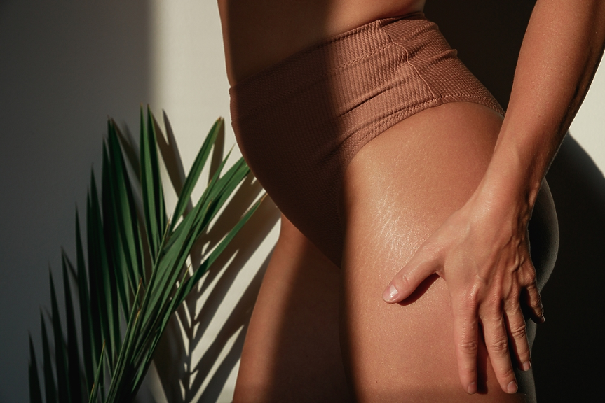 Нормално е и е красиво: Според проучвания стриите засягат между 50% и 80% от жените 